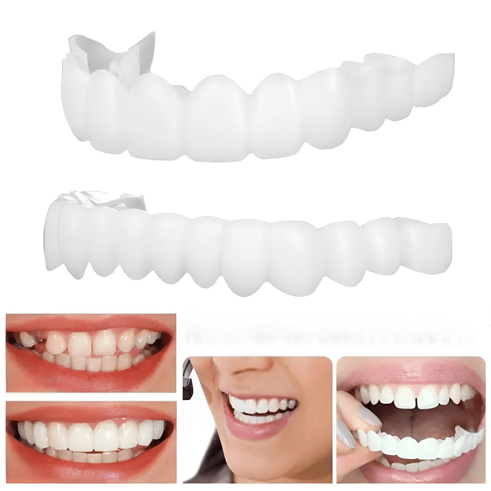 Facetas Dentárias DentalMax | Sorriso Perfeito Sem Dor Nem Dentista